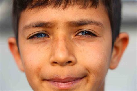 Adanada bir gözü mavi diğerinin de yarısı mavi yarısı kahverengi olan çocuğu görenler hayrete düşüyor